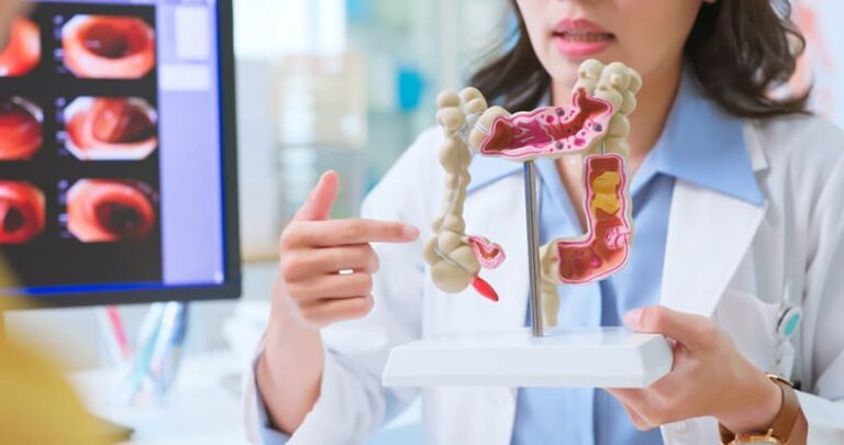 Demostração de como melhorar o funcionamento intestinal