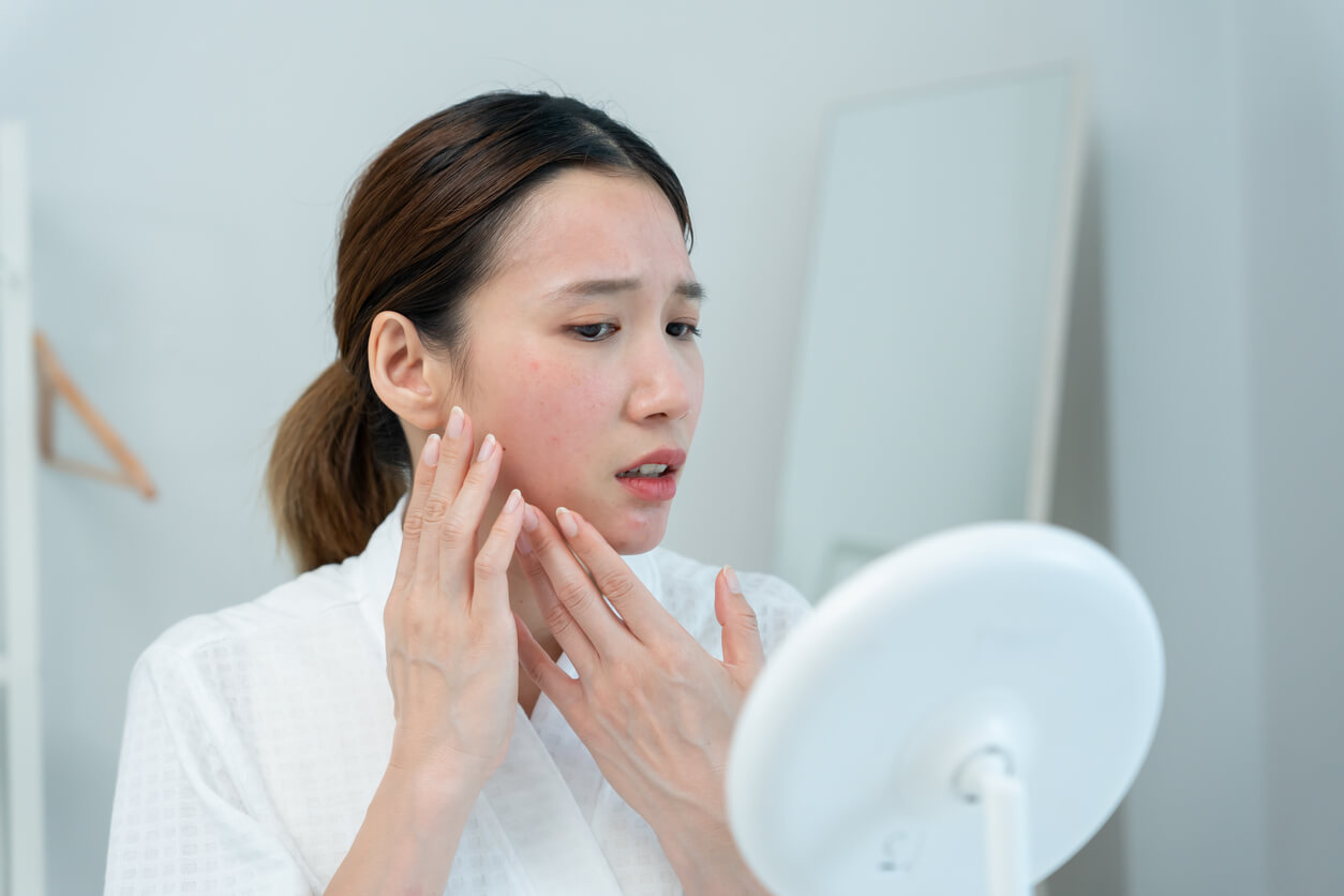 Mulher jovem observa o rosto com acne e irritação na frente do espelho, ilustrando como problemas no intestino podem afetar a saúde da pele.