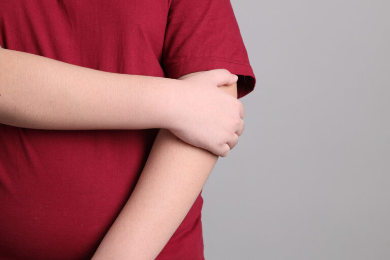 Criança com sobrepeso usando camiseta vermelha, ilustrando o tema da obesidade infantil e seus cuidados preventivos desde a infância.